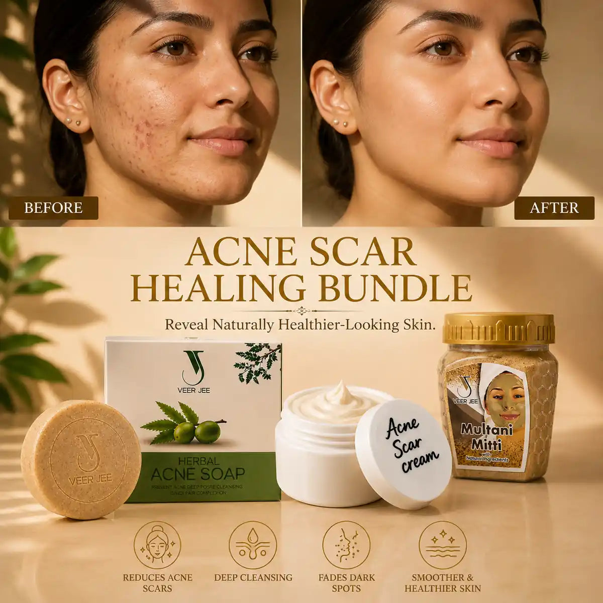 Veer Jee Acne Scar Healing Bundle – 3-step routine with Soap, Multani Mitti and Acne Scar Cream